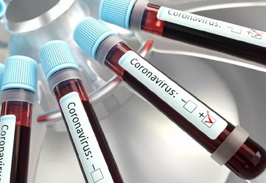 В Хабарах ещё у восьми жителей подтвердилась коронавирусная инфекция